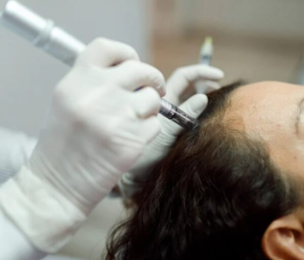 HAARWACHSTUM 1