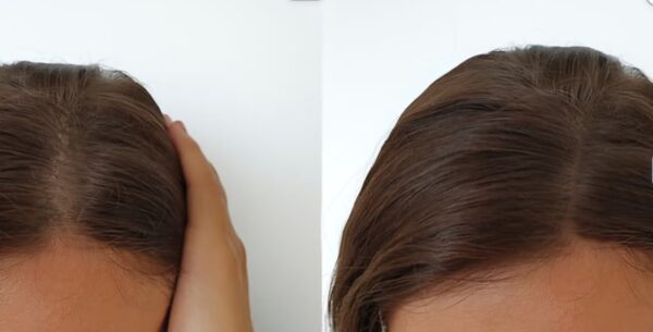 HAARWACHSTUM 4