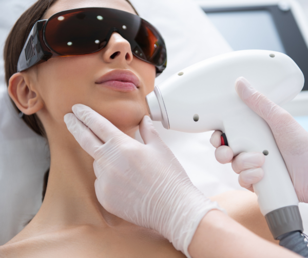 Dauerhafte Laser-Haarentfernung – Alma Soprano Titanium – Kinn oder Wangen