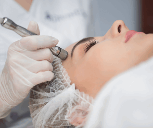 Diamant Mikrodermabrasion – Gesicht Behandlung