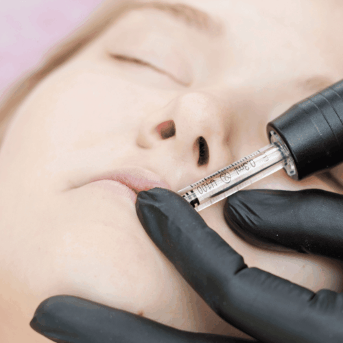 Hyaluron Pen – Lippen ohne Nadeln